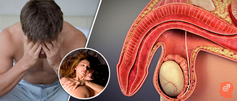 kak-vosstanovit-erektsiyu