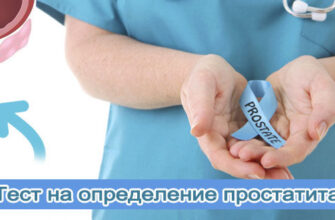 test-na-prostatit-1