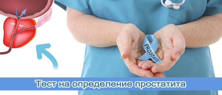 test-na-prostatit-1
